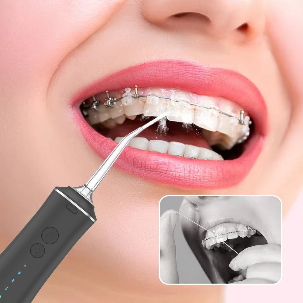 Nettoyeur Dentaire à Jet d’Eau – Hygiène et Sourire Parfait